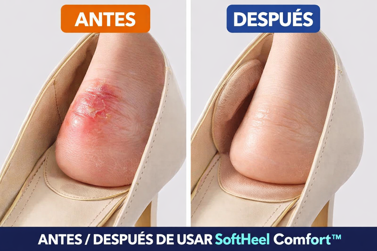 Talonera acolchada ortopédica — alivio inmediato del dolor de talón al caminar