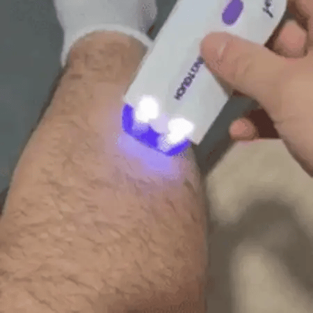 Depiladora corporal recargable — depilación suave, rápida y sin dolor en casa